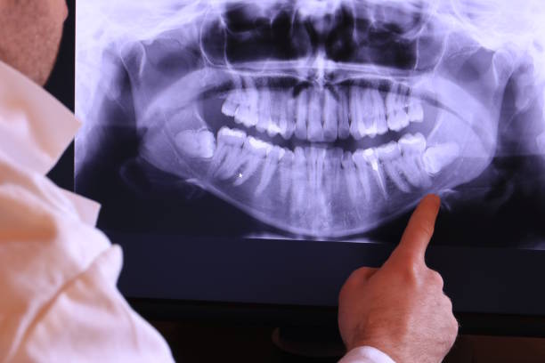 Best Cosmetic Emergency Dentistry in Delavan, WI