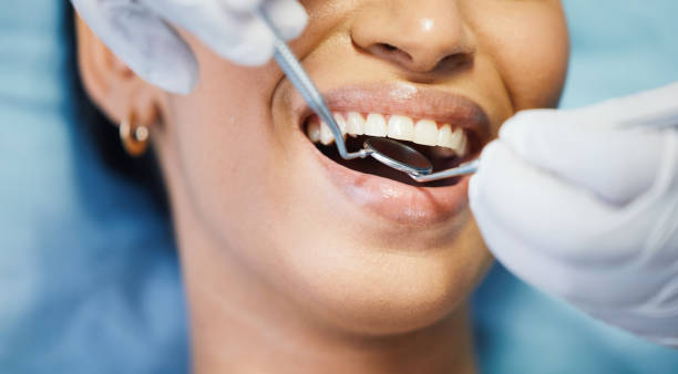 Best Emergency Dental Care for Broken or Chipped Teeth in Delavan, WI
